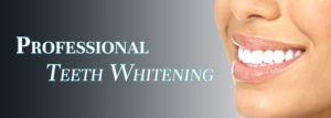 Professional Teeth Whitening Kalispell