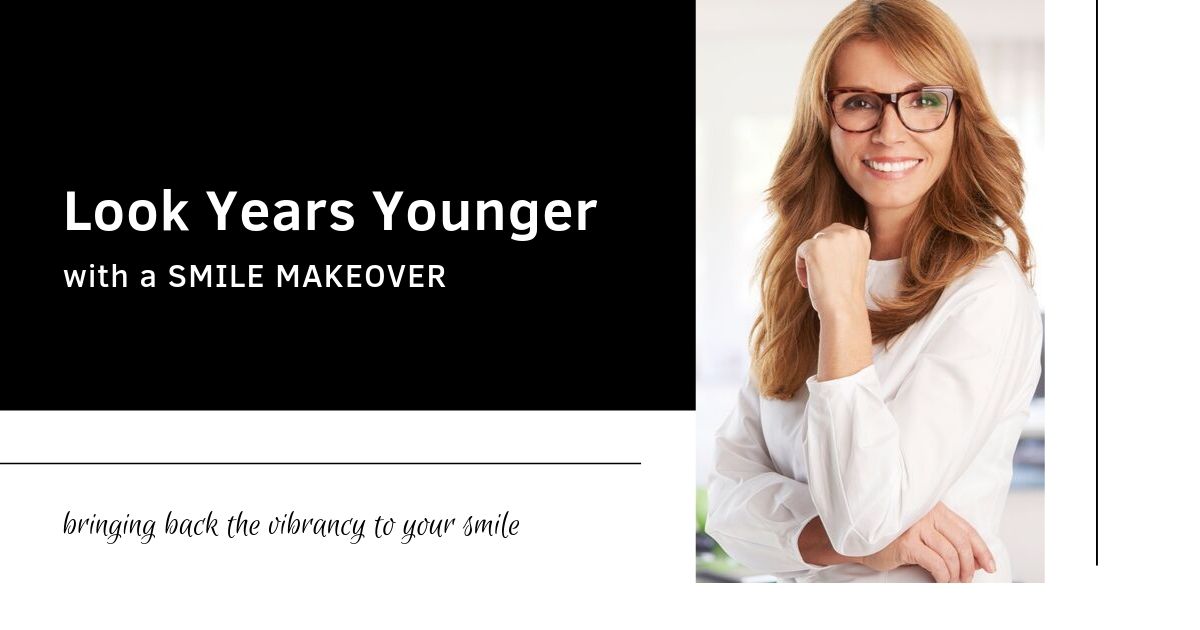 smile makeovers look younger